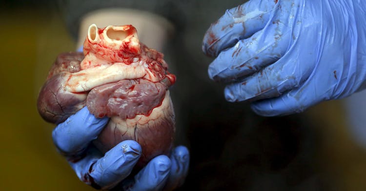 pig s heart A butcher holds the heart of a pig during a butchering competition in Kakucs.JPG